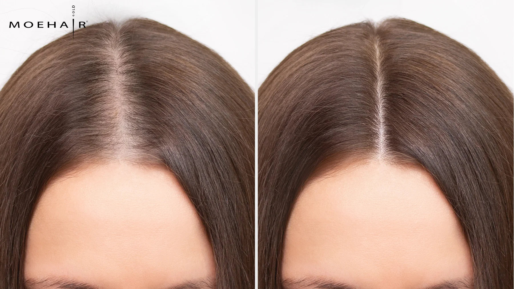 The Ultimate Guide to Anti-Hair Fall Shampoos – Moehair USA Inc.