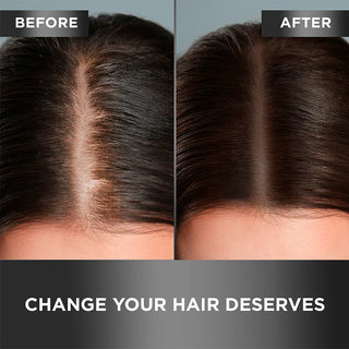 3.38 Oz - Hair Growth Serum & Hair Loss Tonic | Protein Infused | Results Before and After