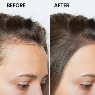 Before and After - hair tonic 